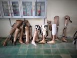 Old and broken devices are always replaced by new ones in order to guarantee the safety and efficiency of the devices used for HI's beneficiaries.  Old and broken devices (here : prosthetic devices) different sizes put into a wall of the Kampong Cham rehabilitation centre.